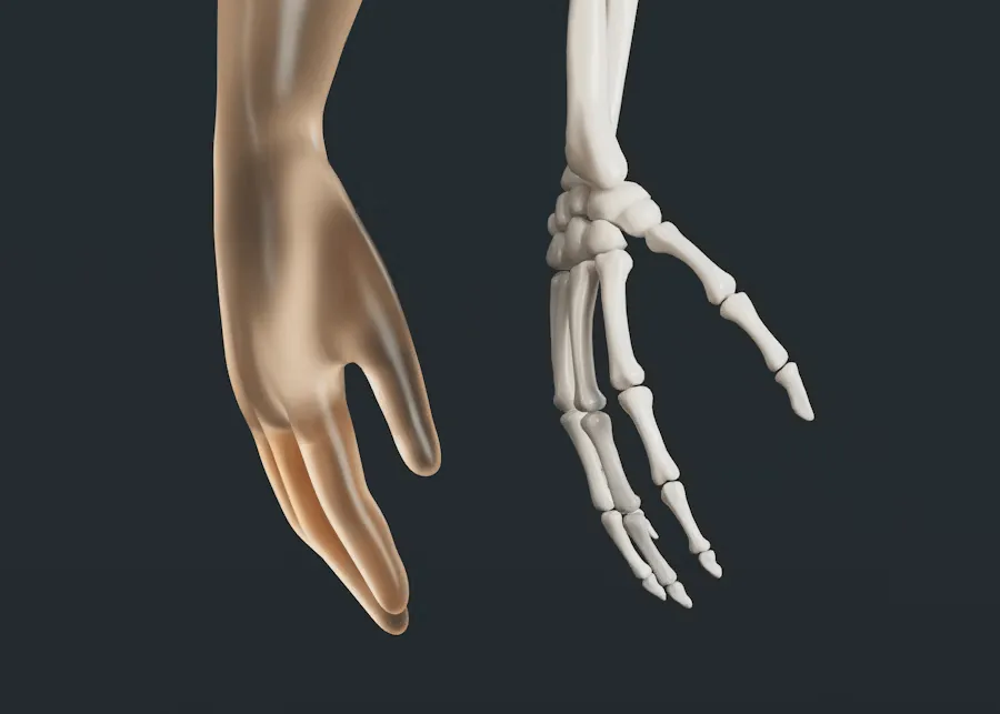Handgelenk, das von Arthrose betroffen ist.